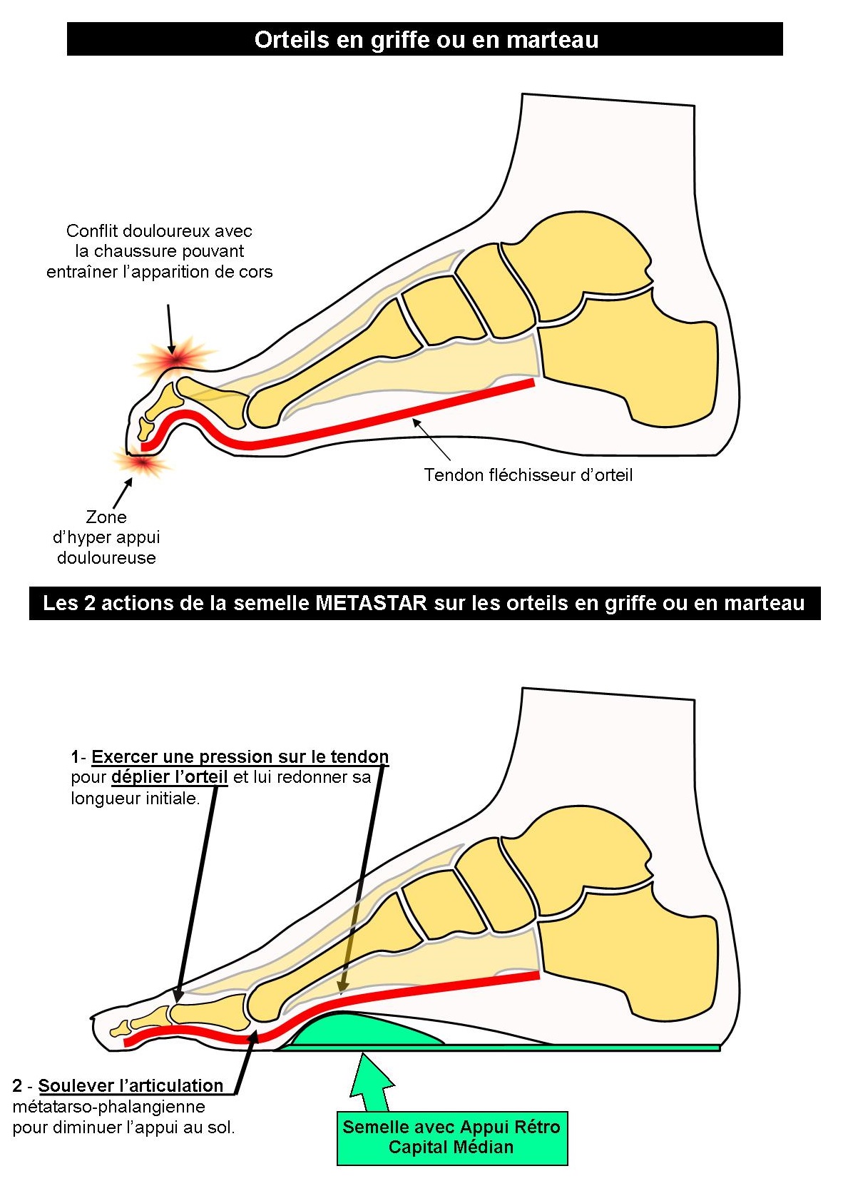Chaussure orteil discount